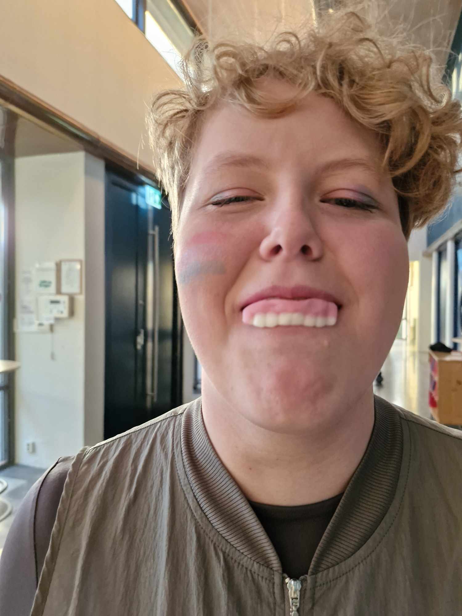 Ein ungdom har godteritenner i munnen og smiler